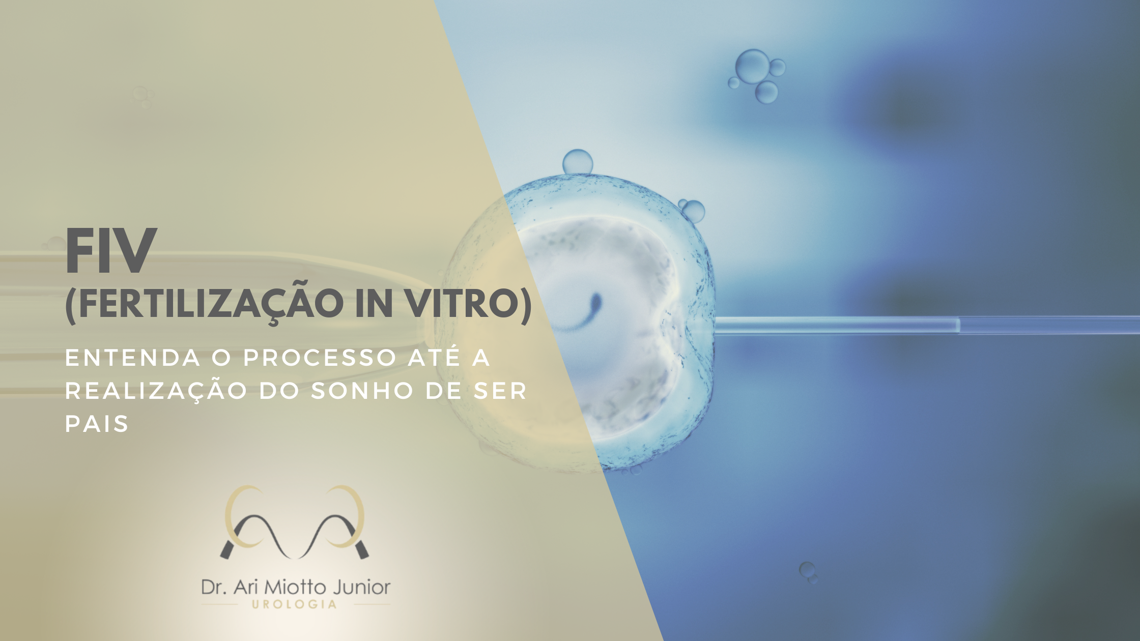 FIV (Fertilização in Vitro)
