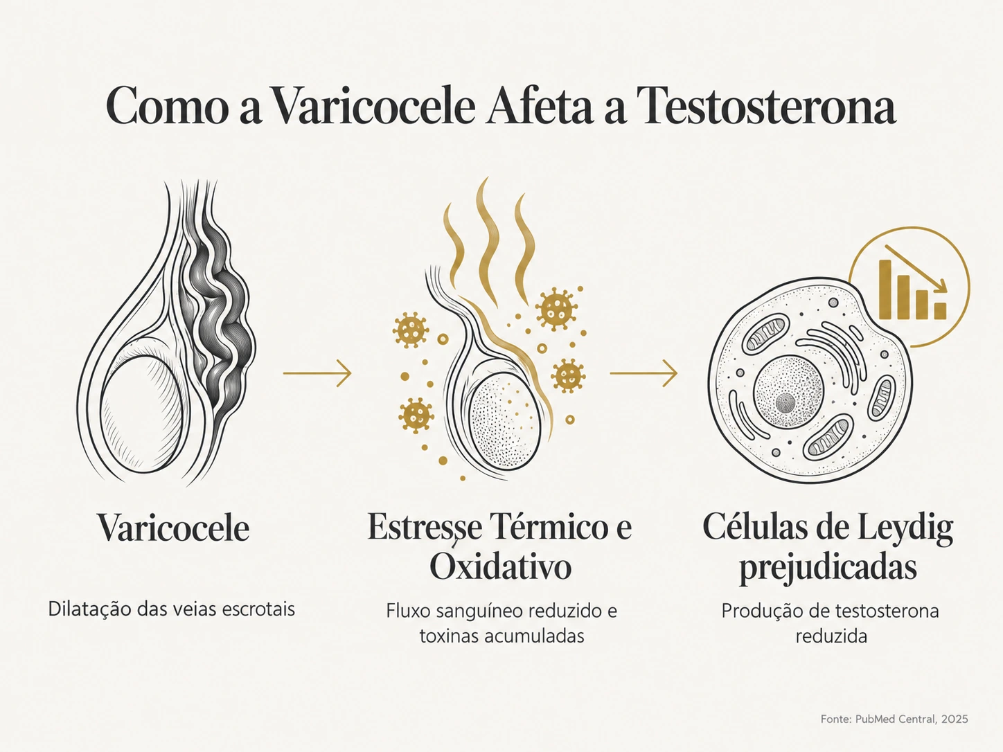 Diagrama explicando como a varicocele prejudica as células de Leydig e reduz a produção de testosterona